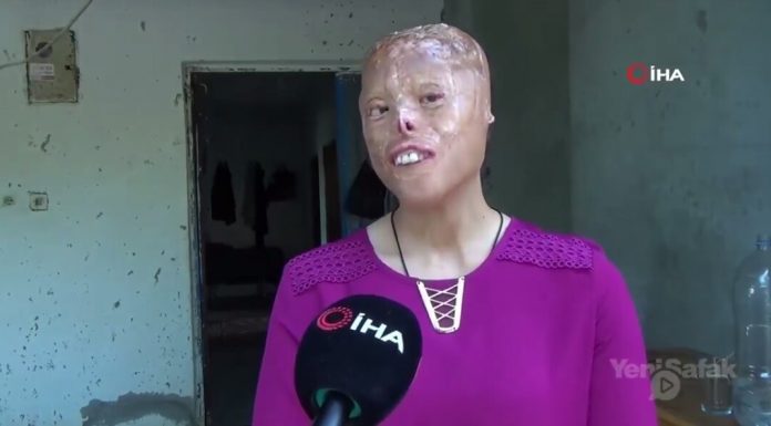 Leyla’ya umut olunmuş..